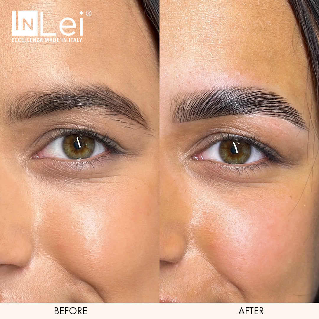 Before and after comparison of a woman's eye with InLei branding.